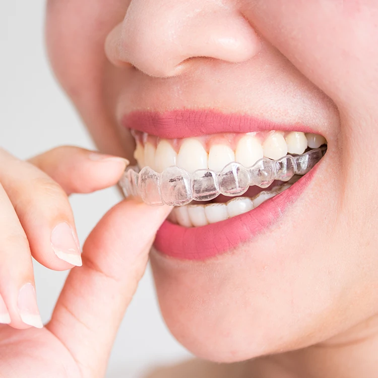 Alineador transparente Invisalign